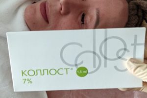 Коллагенотерапия