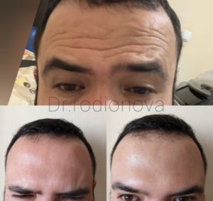 Уколы с бонусами